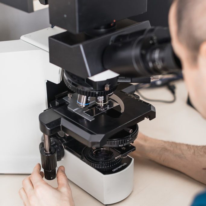 Біопсія ворсин хоріона