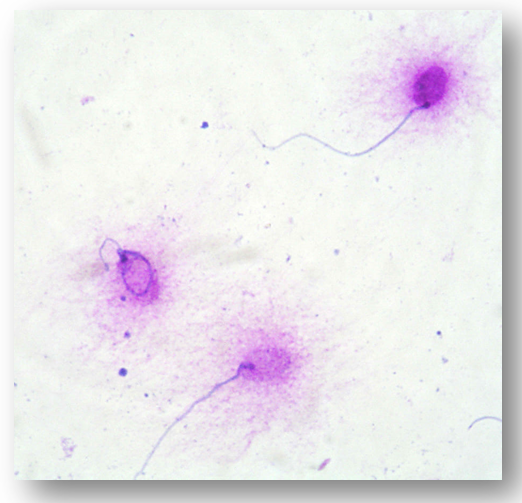 Основні методи діагностики фрагментації ДНК сперми